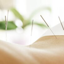 Acupuncture Treatment