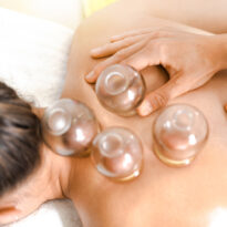 Cupping